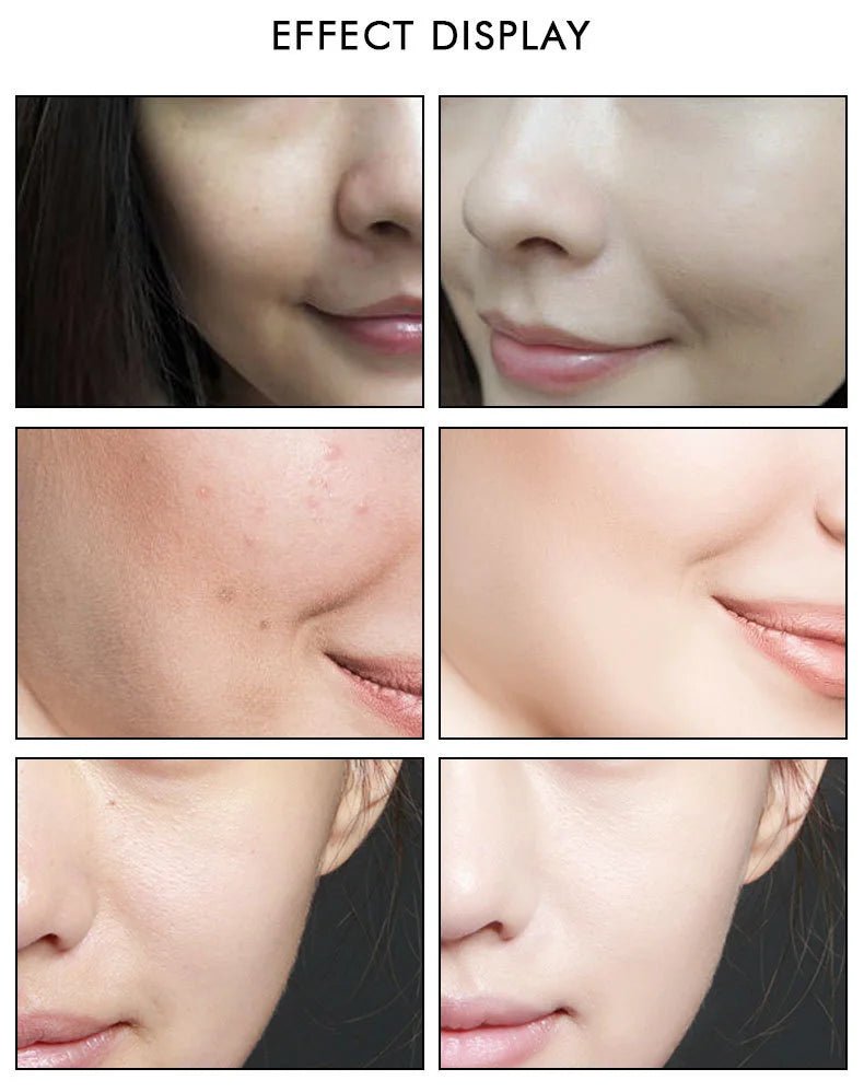 ARTISCARE Nicotinamide + Platinum + 24k Gold Six Peptides Serum 3pcs Moisturizing Smoothing Essence for Face Care - Chrissy's Eye