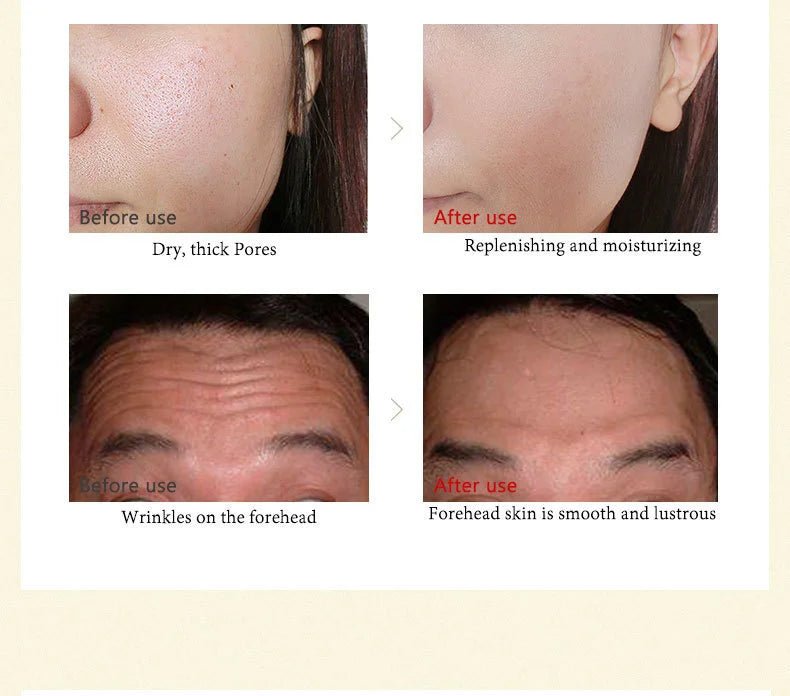 ARTISCARE Nicotinamide + Platinum + 24k Gold Six Peptides Serum 3pcs Moisturizing Smoothing Essence for Face Care - Chrissy's Eye