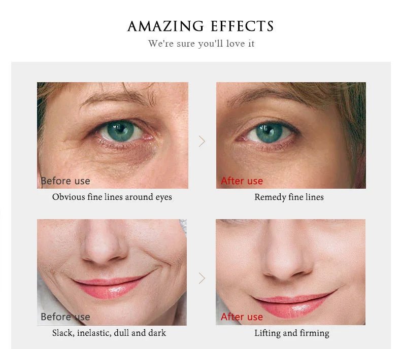 ARTISCARE Gold Niacinamide Face Essence 30mL for Dry Skin Moisturizing Hyaluronic Acid Serum - Chrissy's Eye